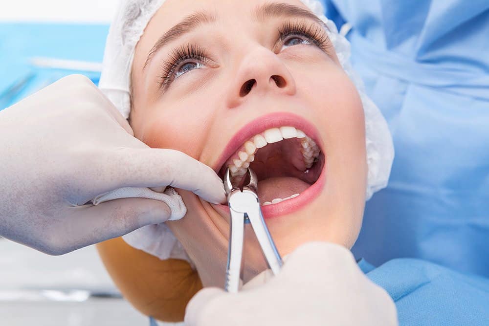 Tooth Extractions at Hudson Dental Center West New York