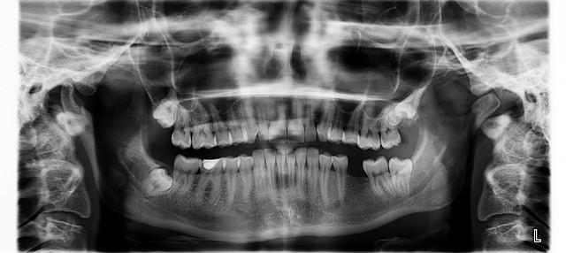 Exams and X-Ray Hudson Dental Center