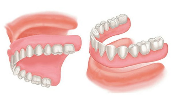 Dentures at Hudson Dental Center West New York