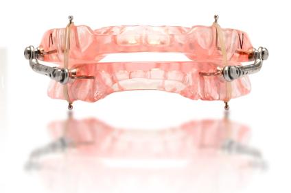 mandibular advancement device